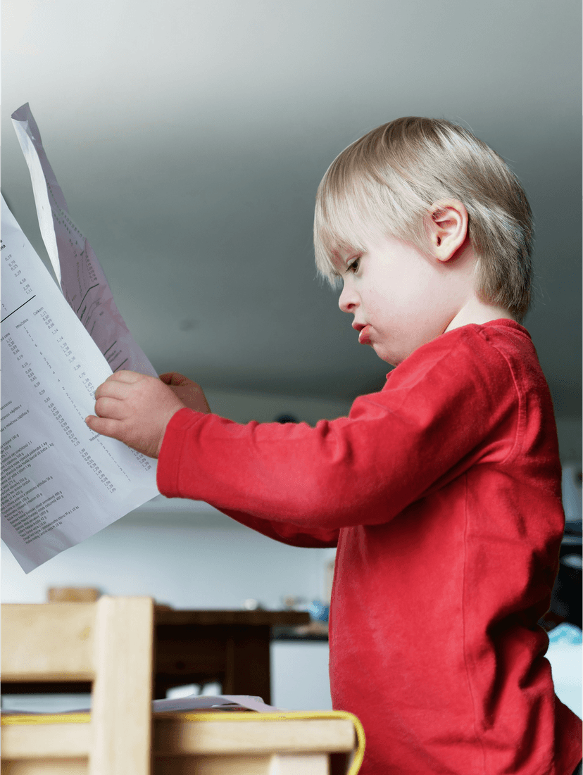 Understanding Down Syndrome: A Comprehensive Guide Article